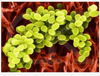 微生物降解技术